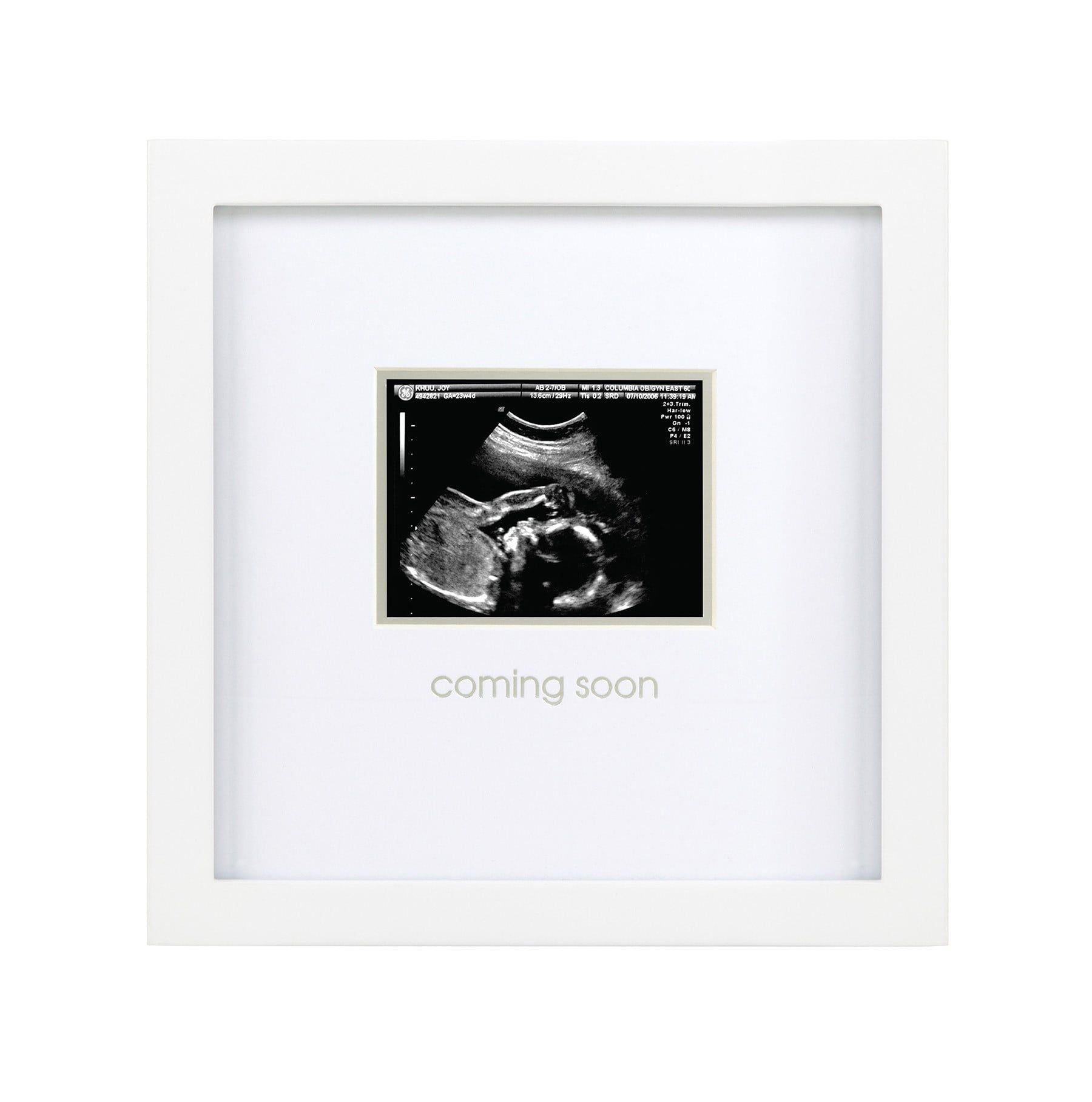 Classic White Wood Wall-Mounted Sonogram Frame