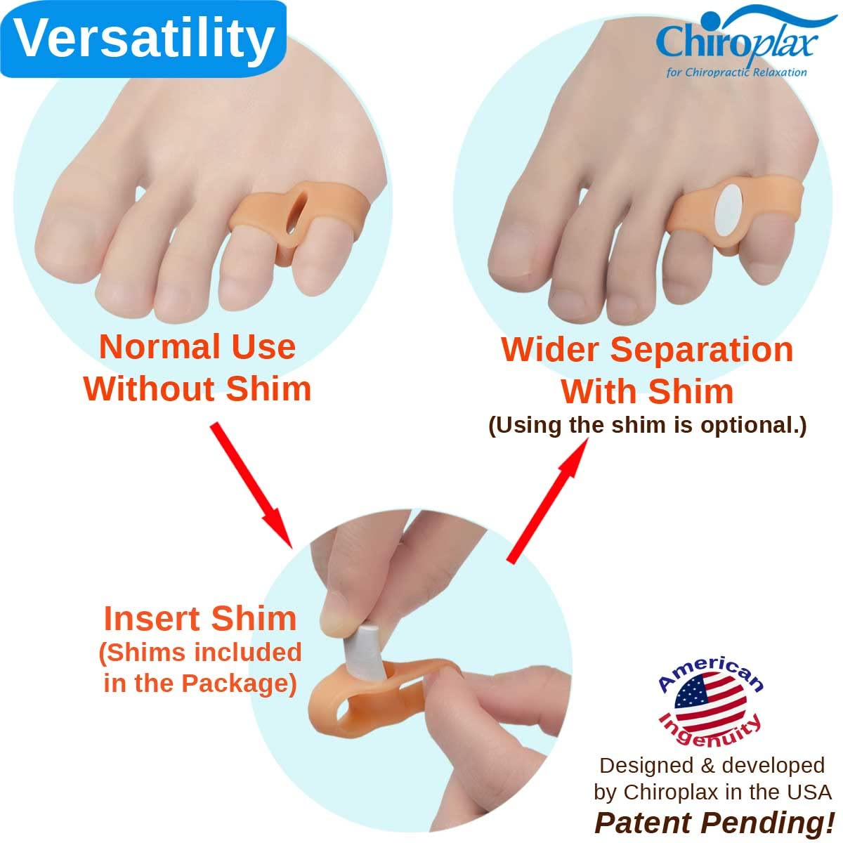 Chiroplax Tailor's Bunion Corrector Pads Bunionette Pain Relief Pinky Toe Straightener Separator Cushion Splint Protector Shield Spacer (4 Pads, Shims - Size Small)