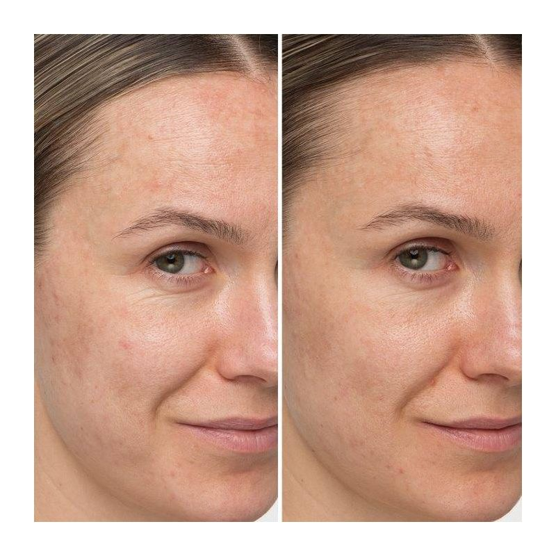 IT Cosmetics Confidence In A Cream Anti-Aging Face Moisturizer - 2oz - Ulta Beauty