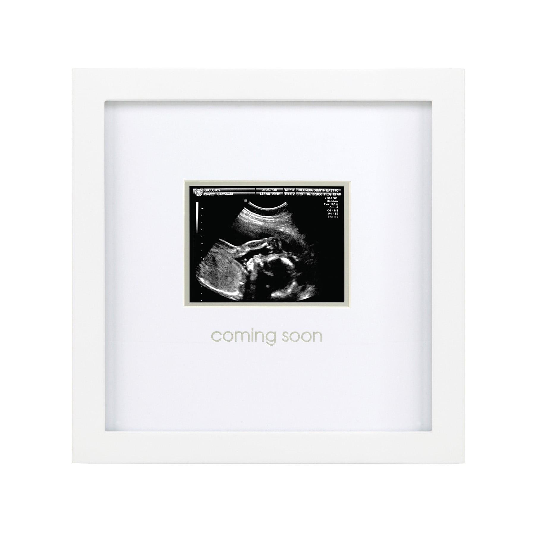 Classic White Wood Wall-Mounted Sonogram Frame