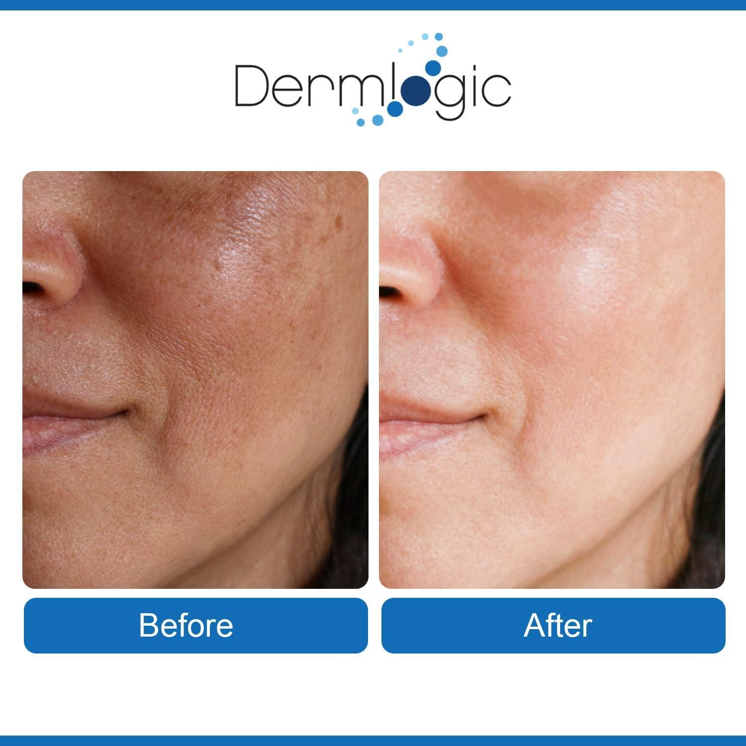 Dermlogic Anti Aging Pads