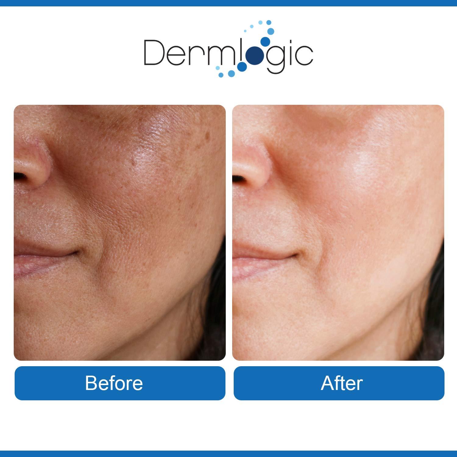Dermlogic Anti Aging Pads