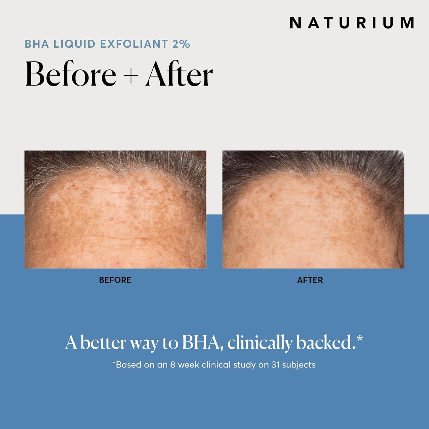 Naturium BHA Liquid Exfoliant 2% - 4 fl oz