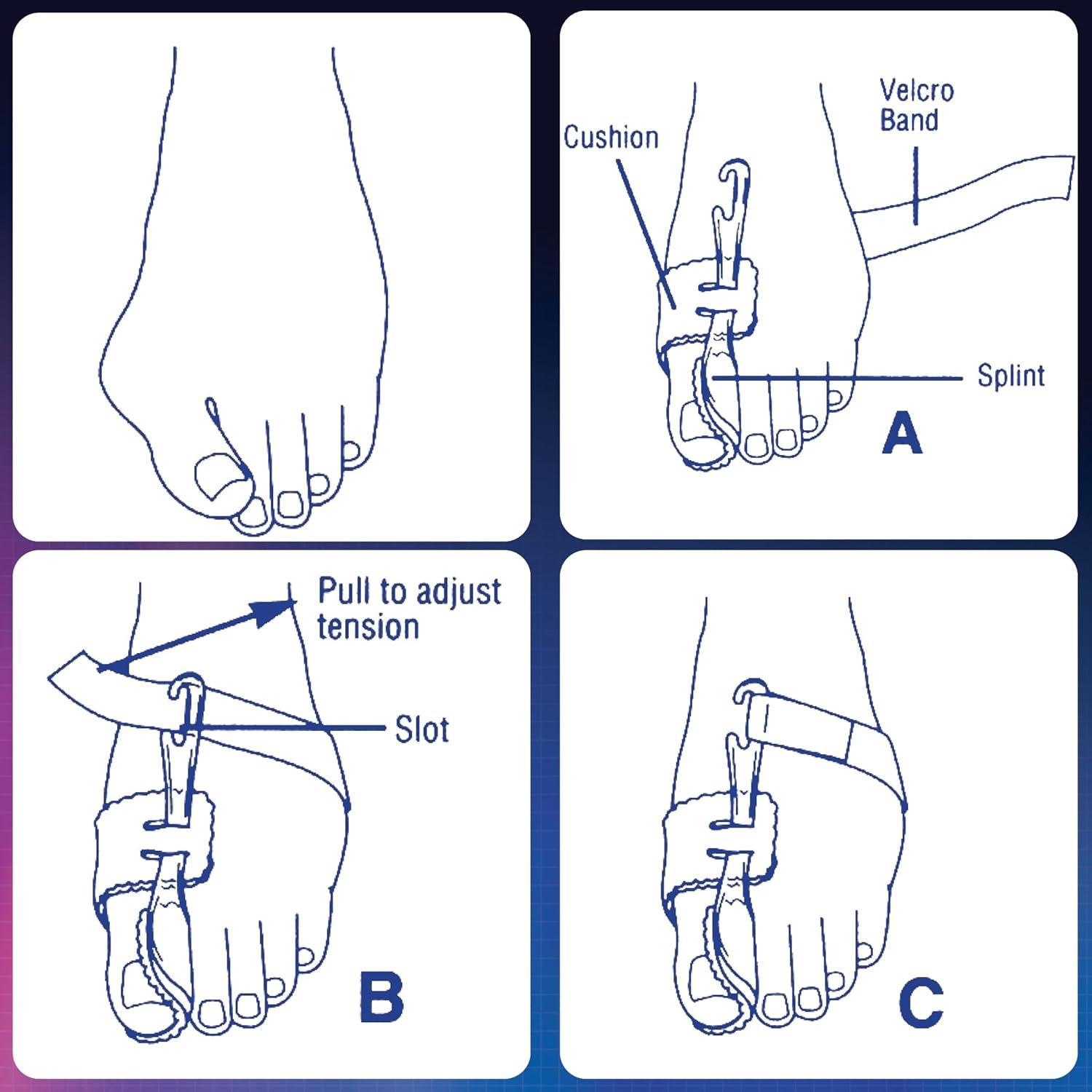 PediFix Nighttime Bunion Regulator, Right Foot, Medium