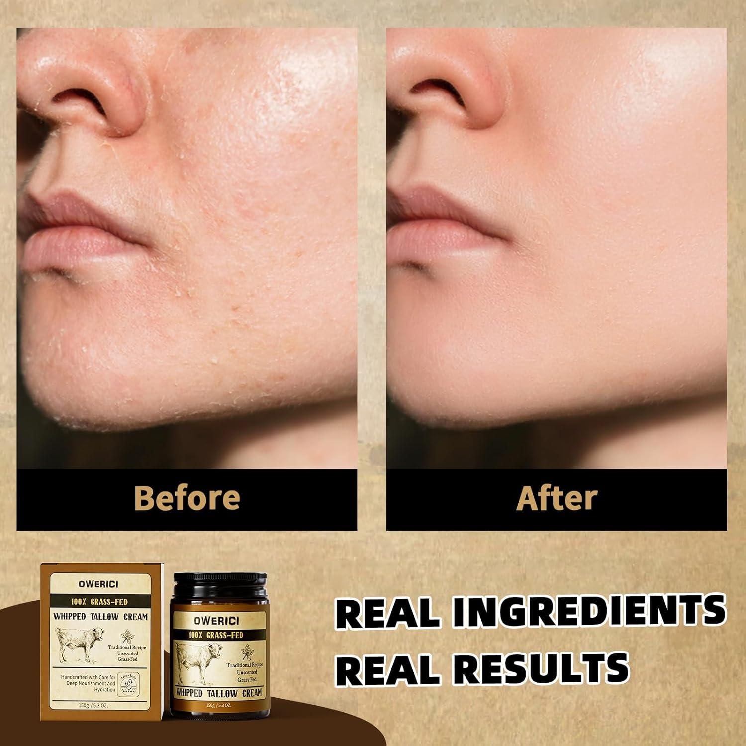 Beef Tallow for Skin, Tallow Face Moisturizer, 100% Grass Fed and Finished, Deeply Moisturizing for Face & Body, Whipped Cream Natural Care for Soft Supple (5.3 OZ., Extra Large)