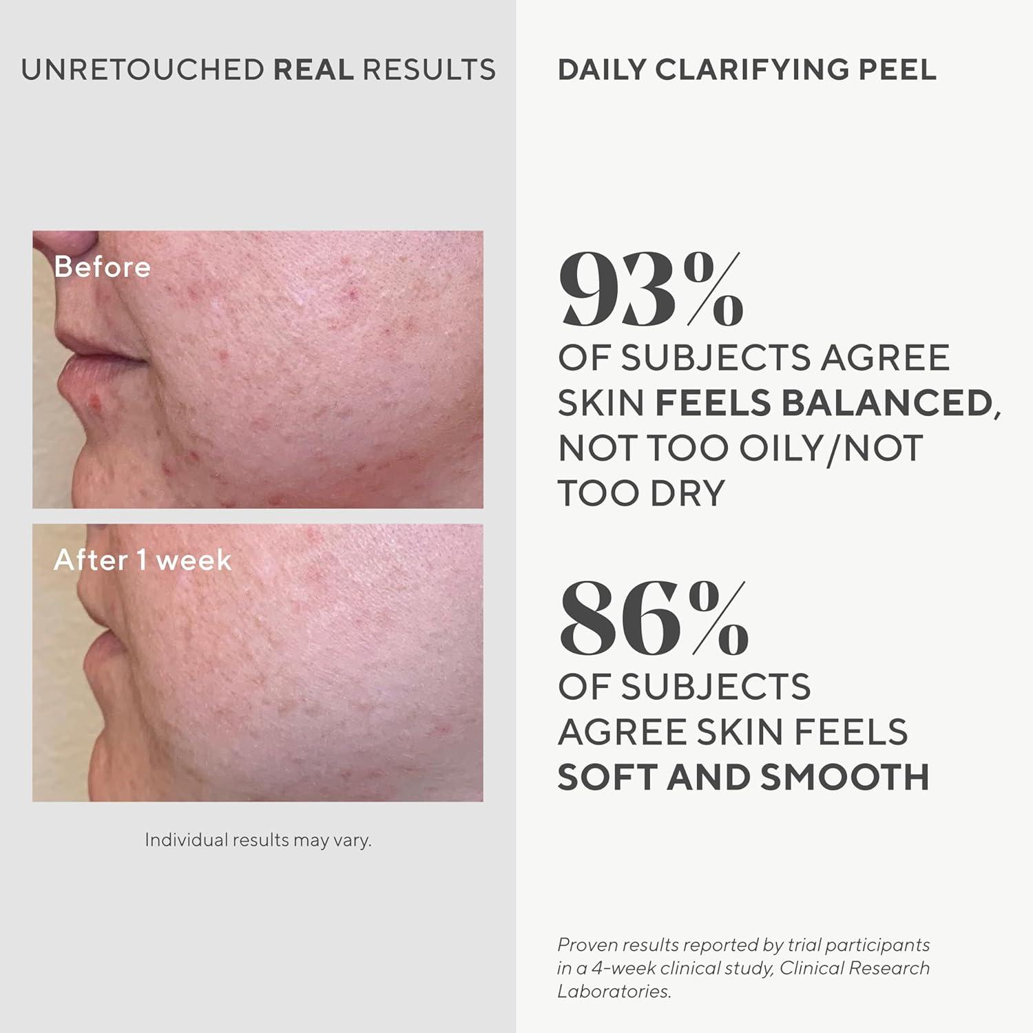 Daily Clarifying Exfoliating Peel with AHA/BHA and Retinoid