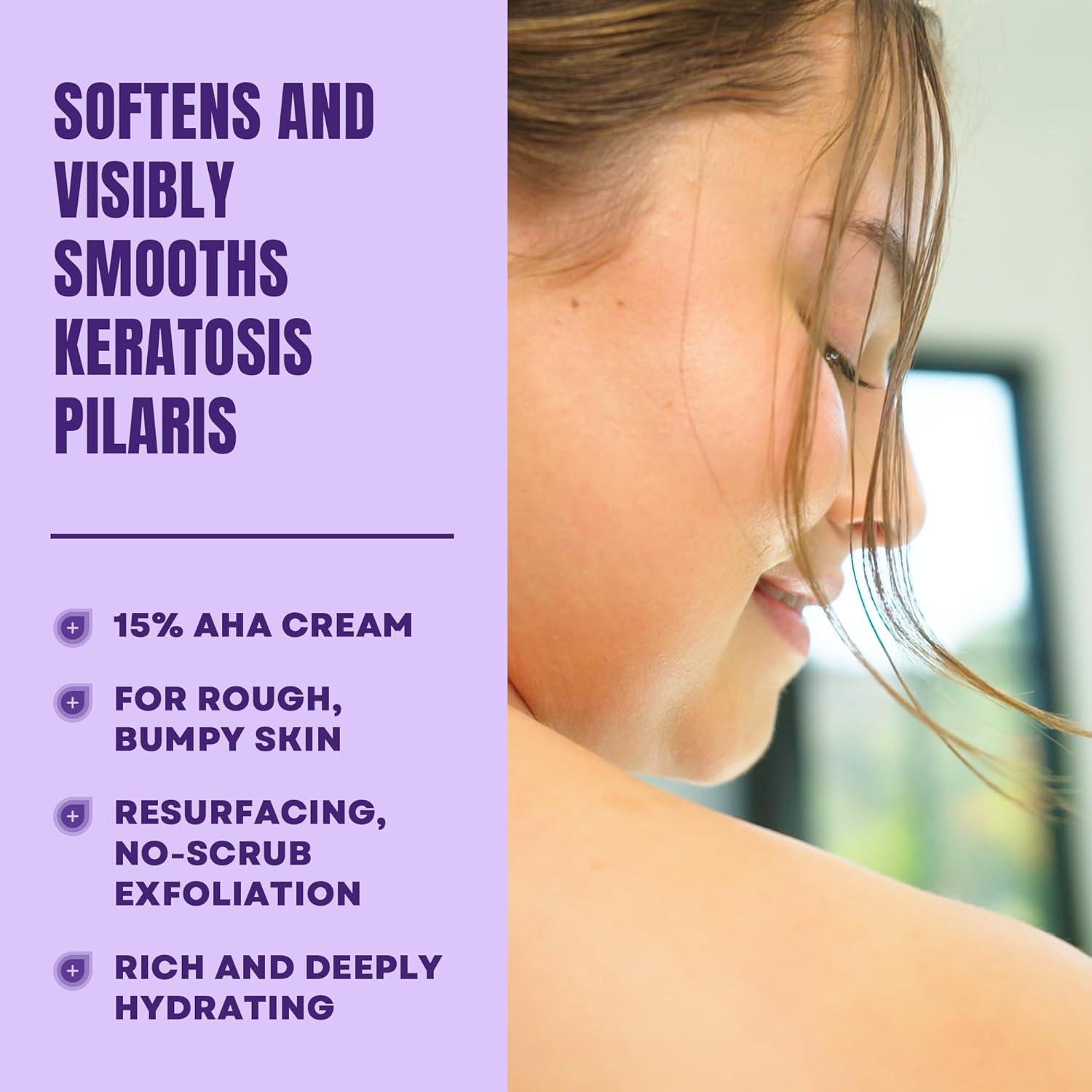 AmLactin KP Bumps Be Gone - 3 oz Keratosis Pilaris Moisturizing Cream with 15% Lactic Acid - Exfoliator and Moisturizer for Dry, Rough and Bumpy Skin (Packaging May Vary)