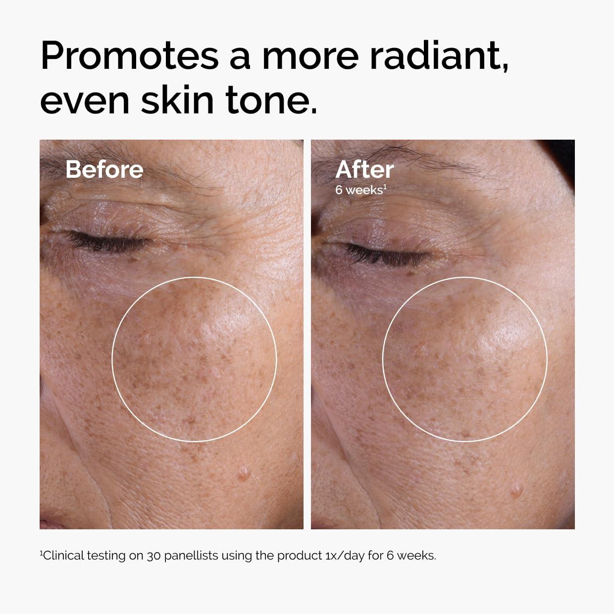 The Ordinary Glycolic Acid 7% Toning Solution - 3.38 fl oz - Ulta Beauty