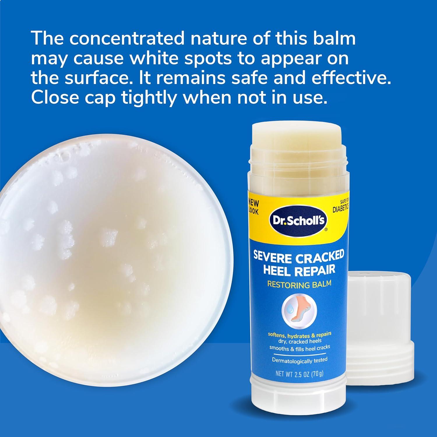 Dr. Scholl's Cracked Heel Repair Balm (2.5oz) 25% Urea. Heals and Moisturizes feet