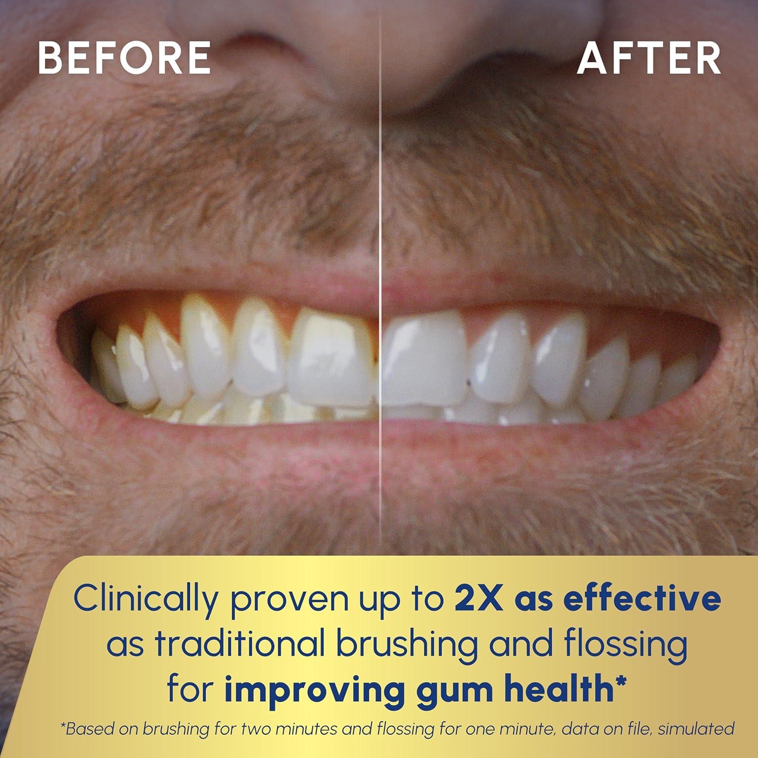 Waterpik Sonic-Fusion 2.0 Professional Flossing, Electric Toothbrush - Black-