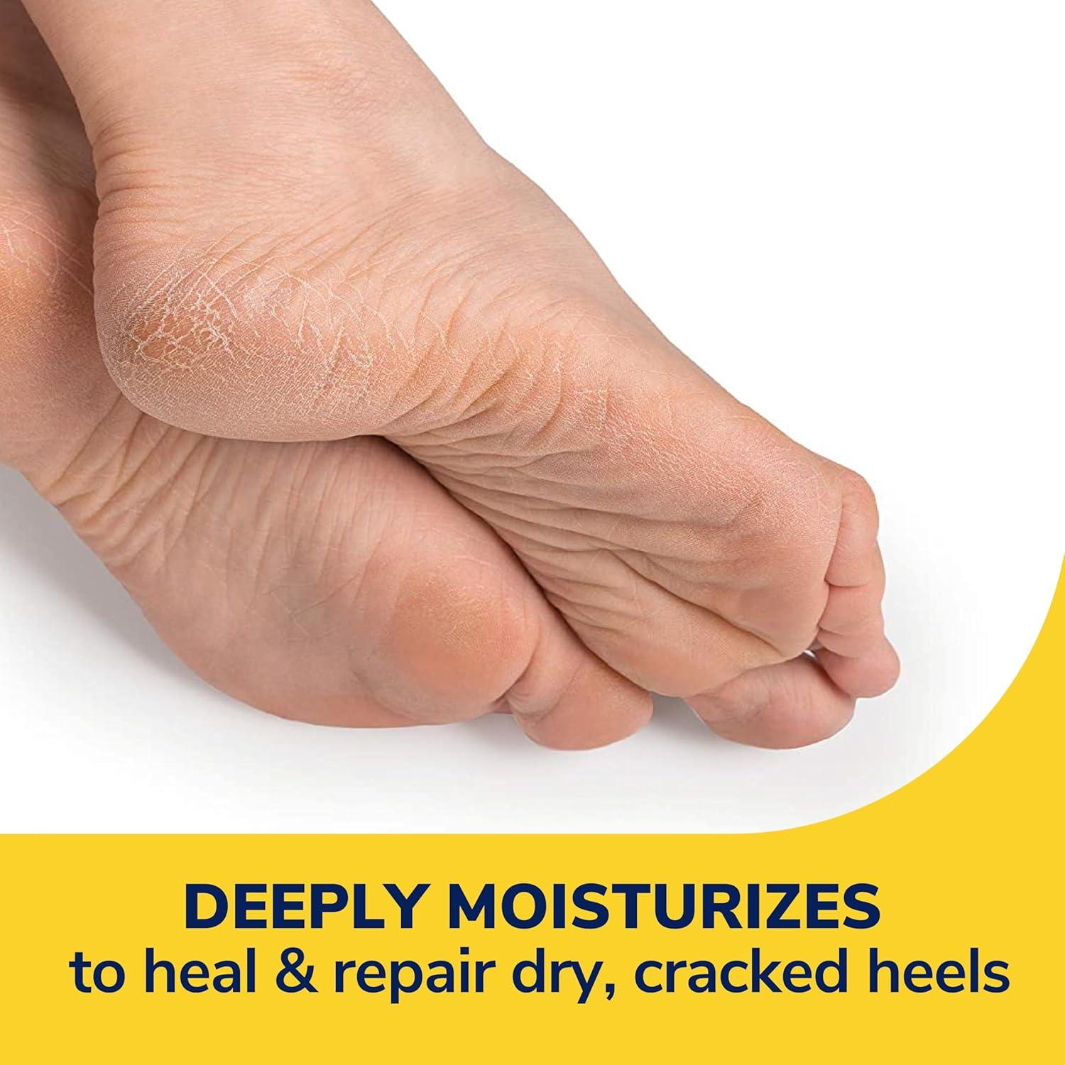 Dr. Scholl's Cracked Heel Repair Balm (2.5oz) 25% Urea. Heals and Moisturizes feet