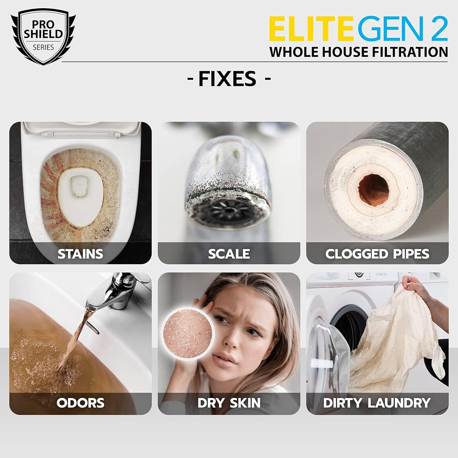 Elite Whole House Water Filter 3-Stage Well Water Filtration System with Gauges, PR Button 1 in. Ports Filter Set