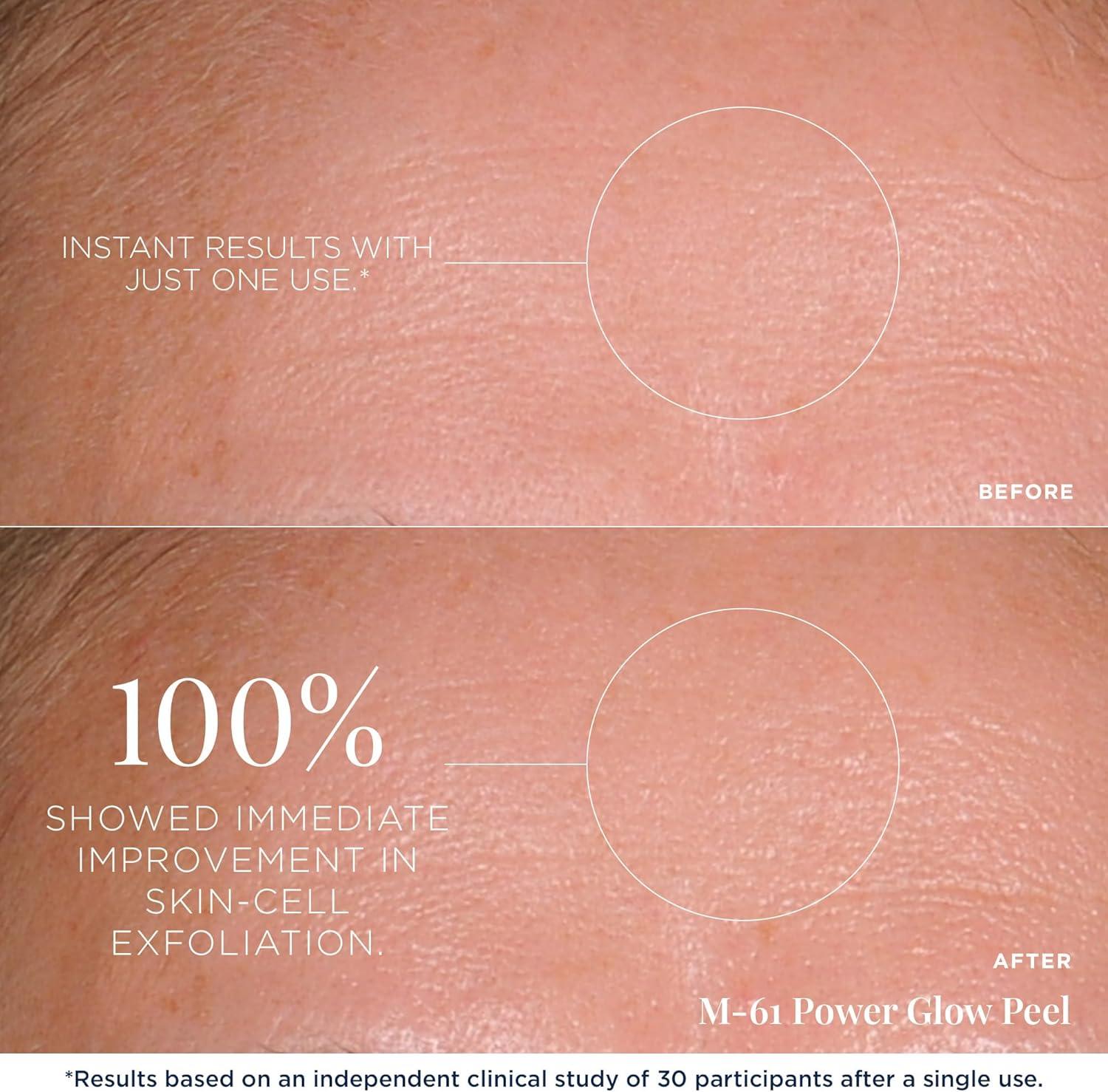 PowerGlow 1-Minute Exfoliating Peel with Glycolic and Salicylic Acid